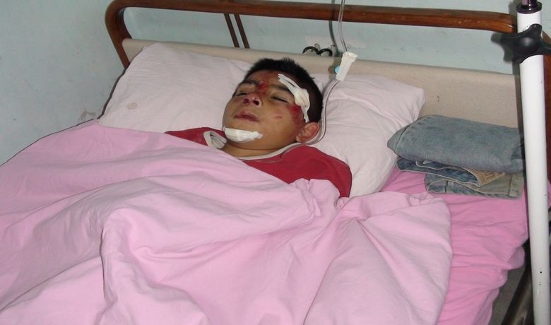 Bindikleri Bisiklet Devrildi: 3 Yaralı