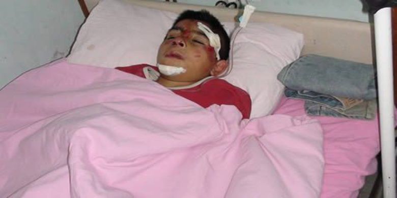 Bindikleri Bisiklet Devrildi 3 Yaralı Bindikleri Bisiklet Devrildi 3 Yaralı